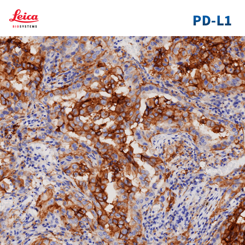 PD-L1检测试剂盒(免疫组织化学法)