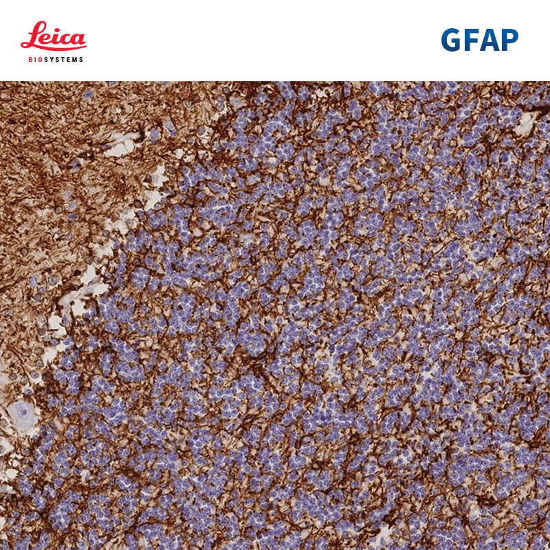 GFAP抗体试剂