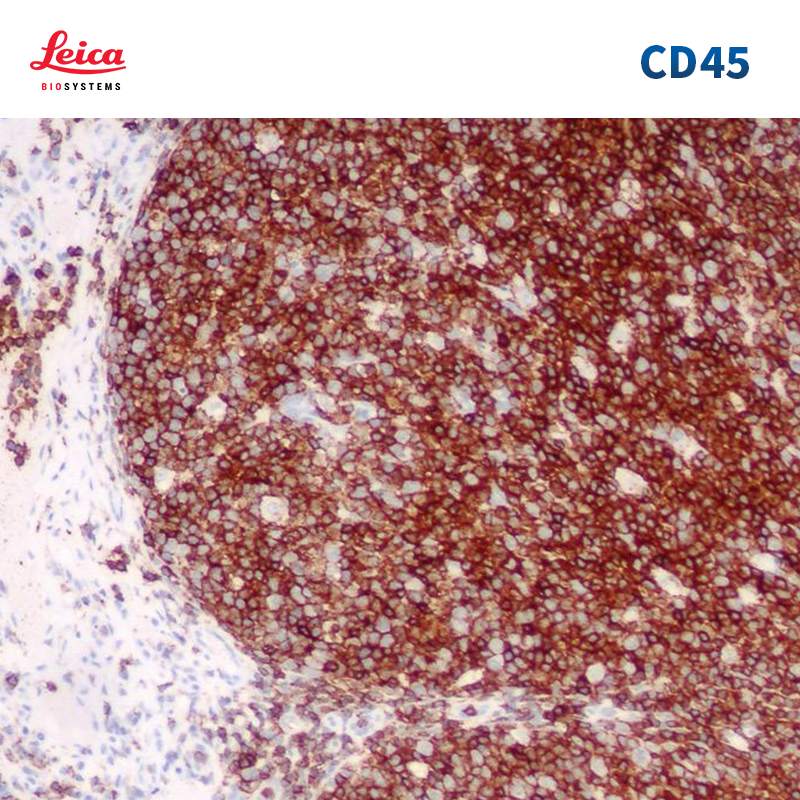 CD45抗体试剂