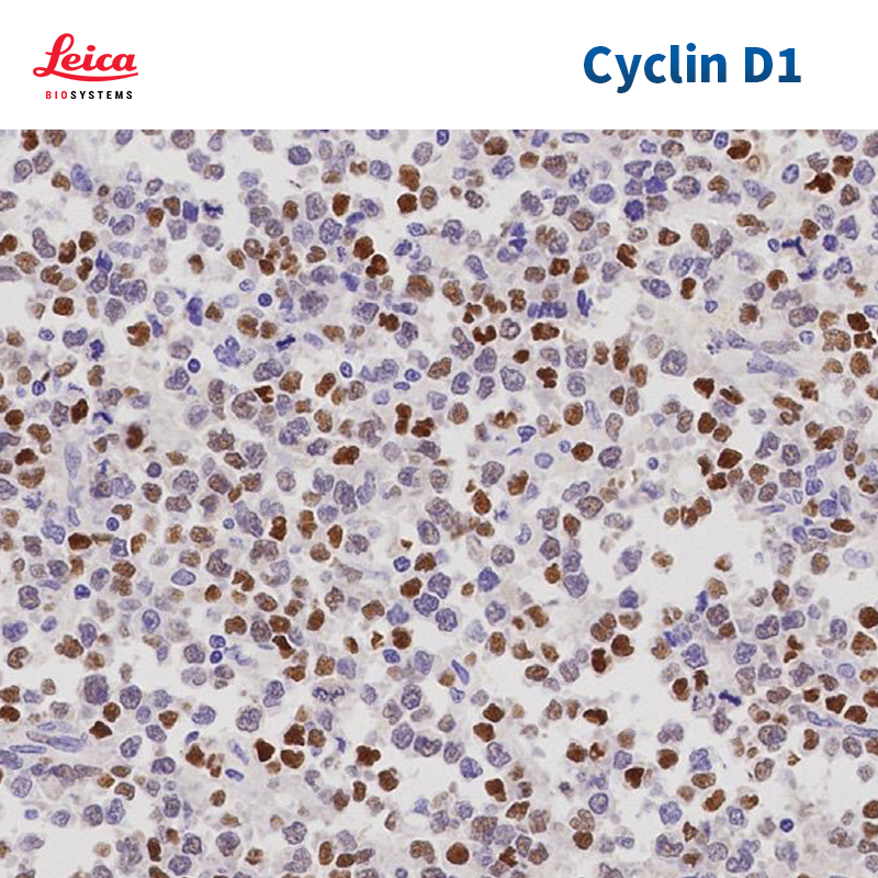 细胞周期蛋白D1（Cyclin D1）抗体试剂