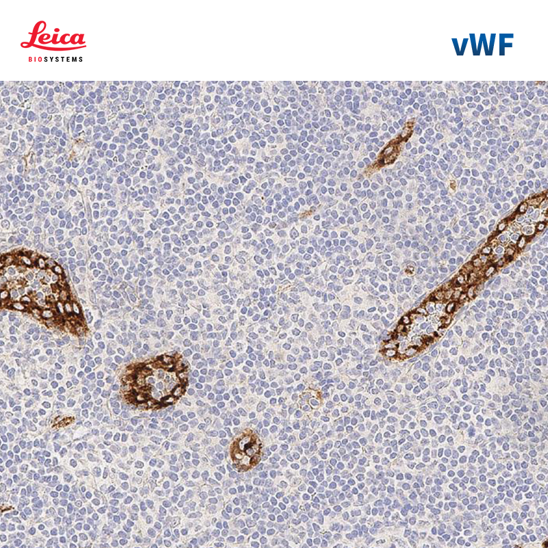 血管性血友病因子（vWF）抗体试剂