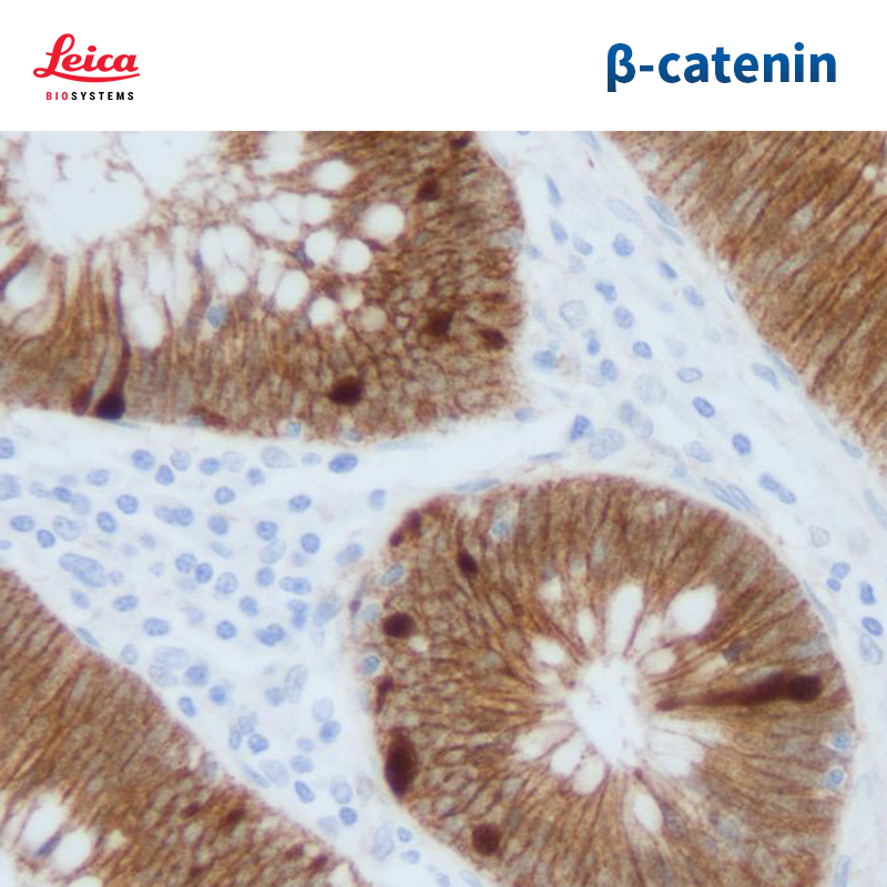 Beta-catenin抗体试剂