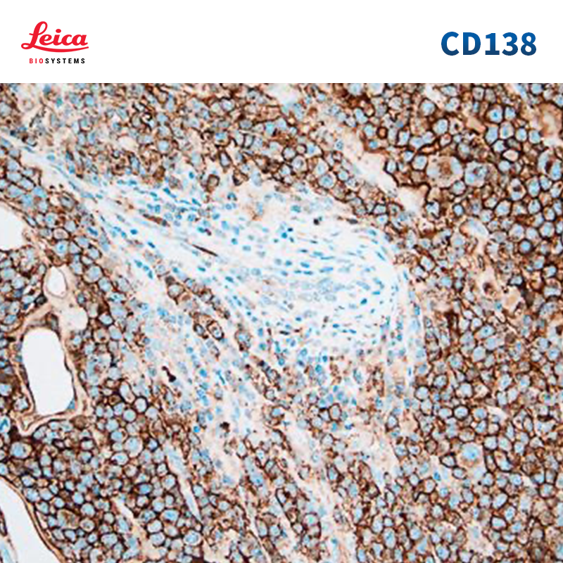 CD138抗体试剂