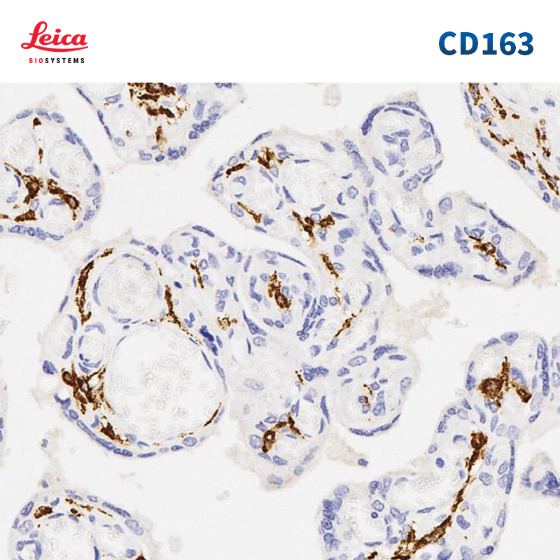 CD163抗体试剂
