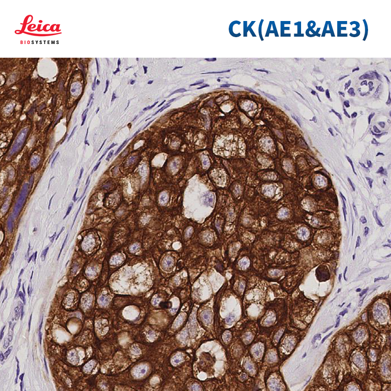 AE1/AE3混合分子量角蛋白（AE1/AE3）抗体试剂
