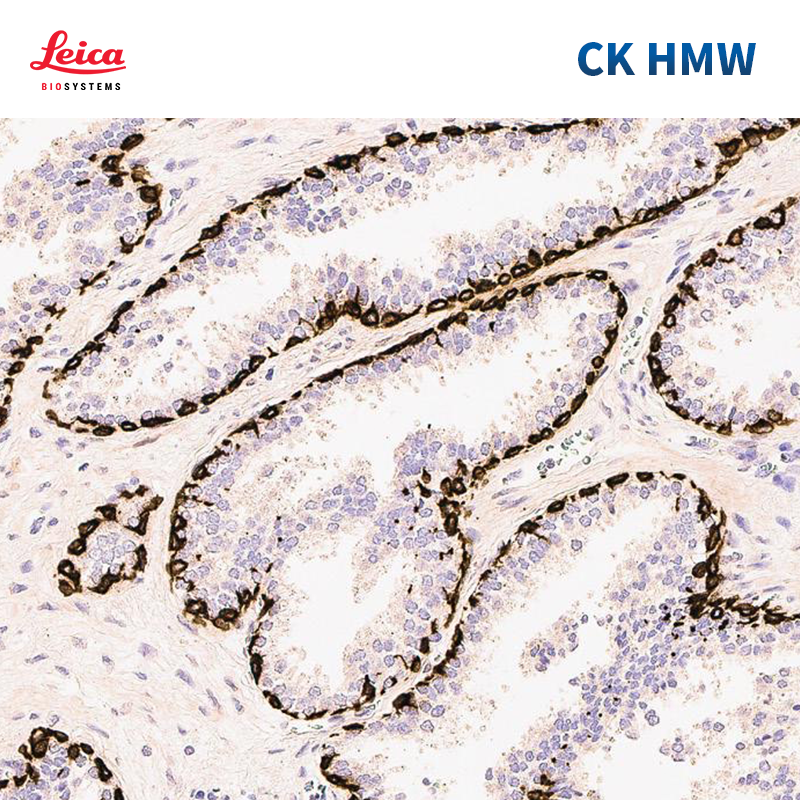 细胞角蛋白CK34BetaE（高分子量）抗体试剂