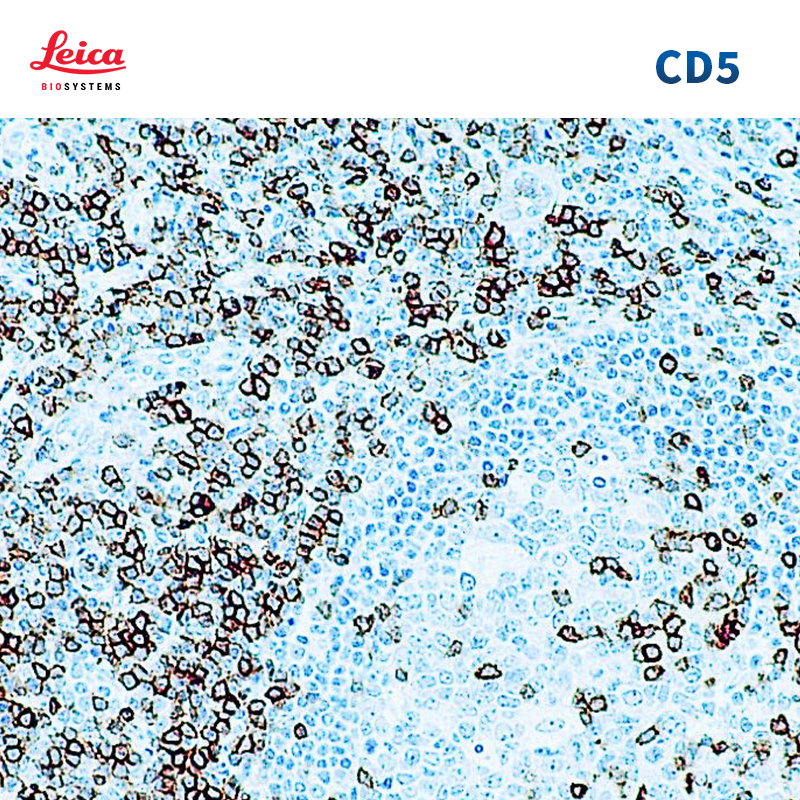 CD5抗体试剂