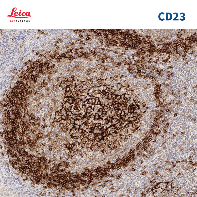 CD23抗体试剂