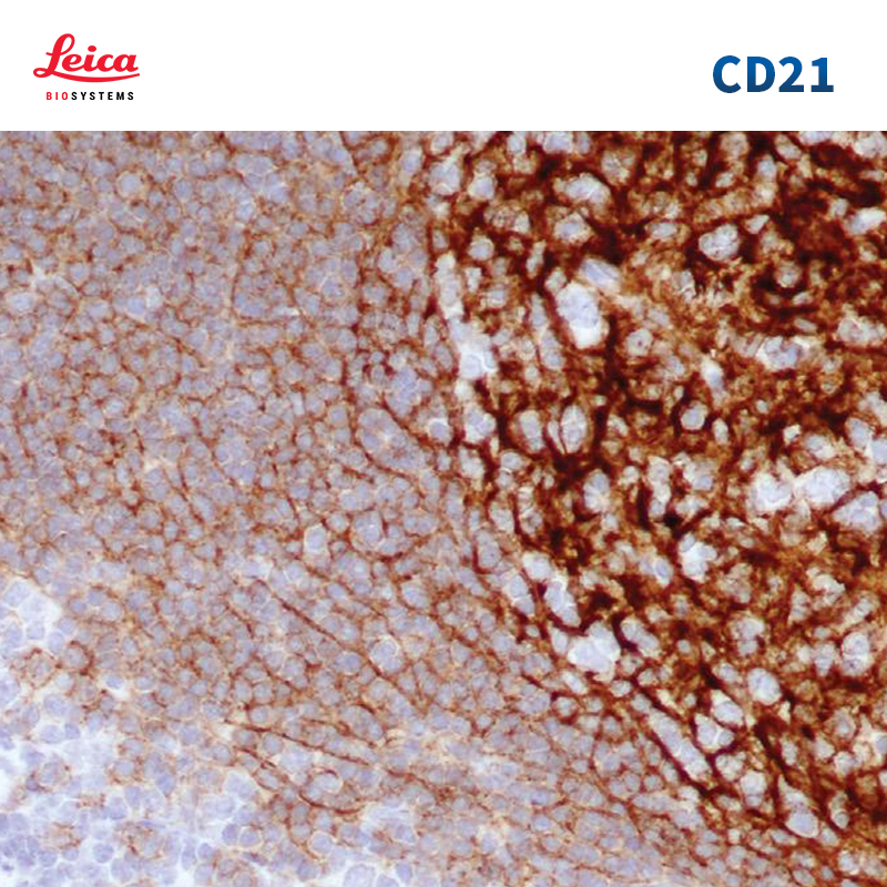 CD21抗体试剂