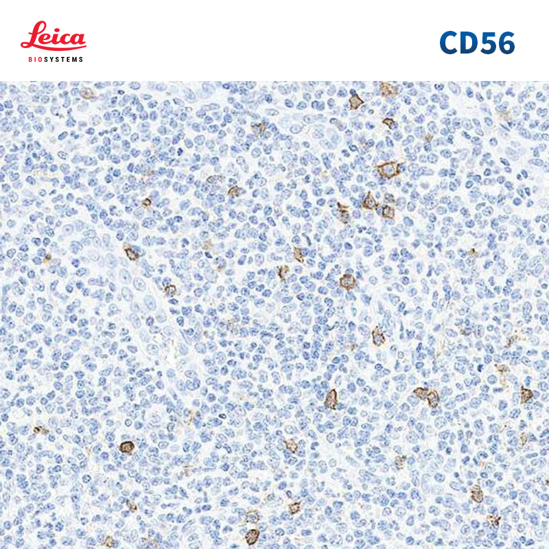 CD56抗体试剂