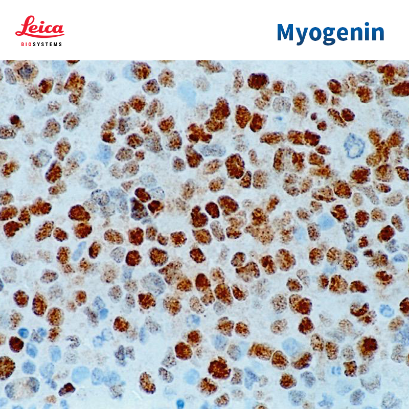 肌浆蛋白（Myogenin）抗体试剂