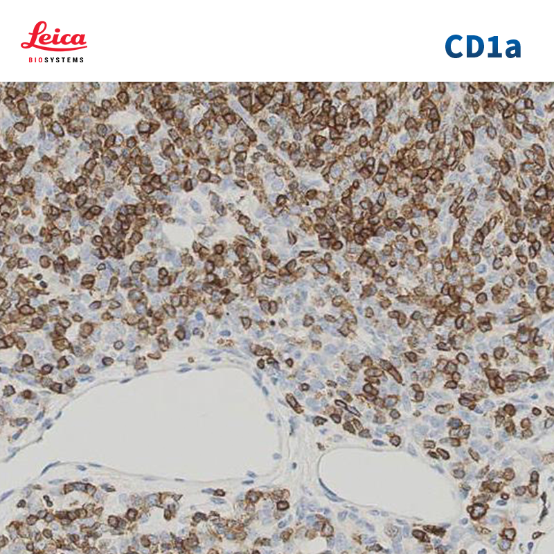 CD1a抗体试剂