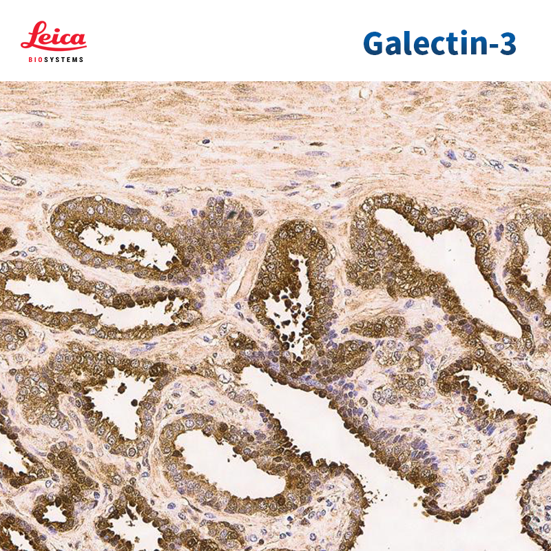 Galectin-3抗体试剂