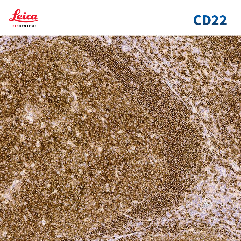CD22抗体试剂