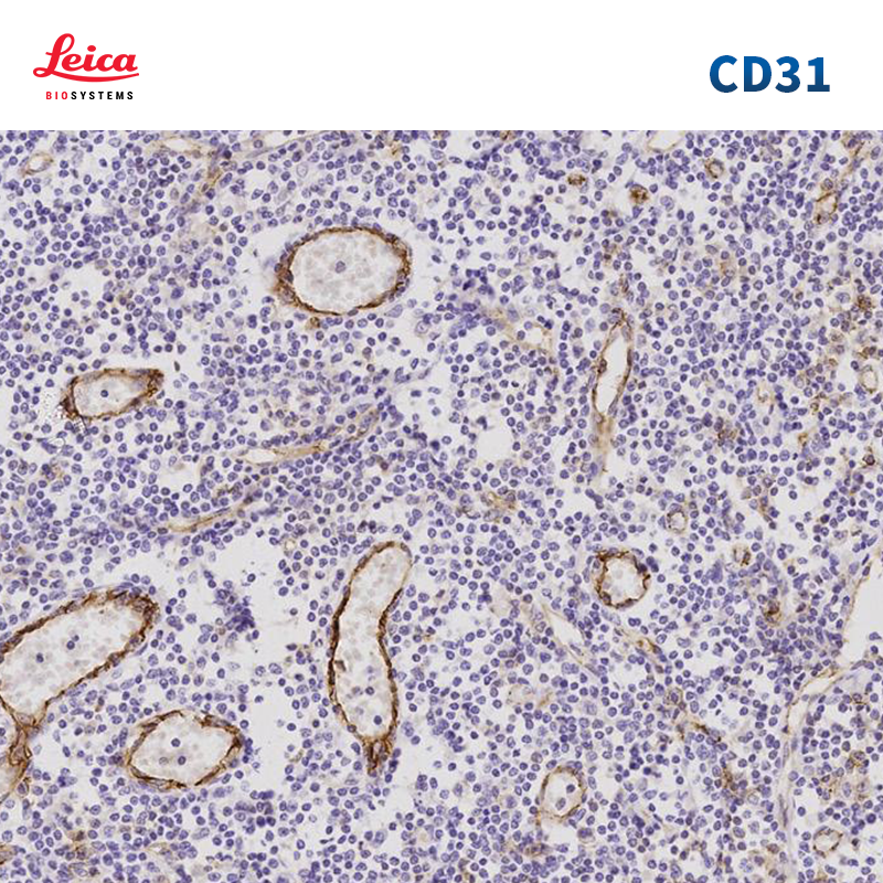 CD31抗体试剂