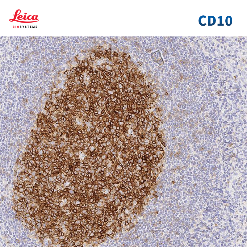 CD10（56C6）抗体试剂