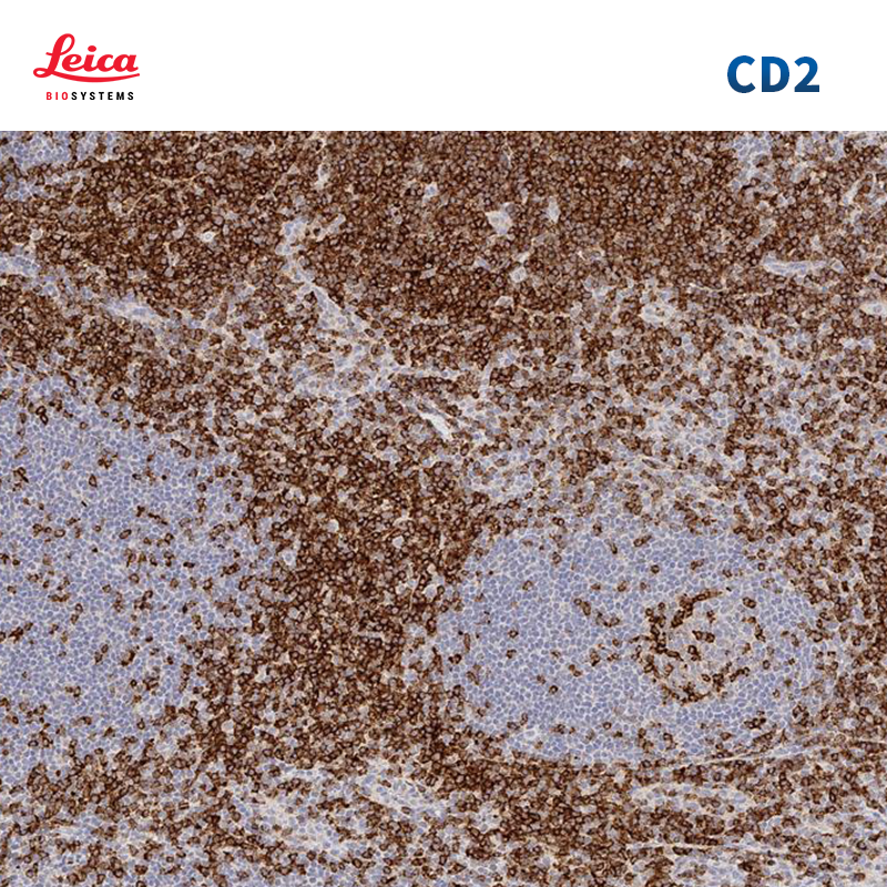 CD2抗体试剂