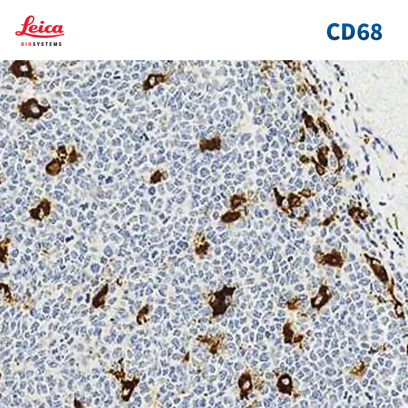 CD68抗体试剂