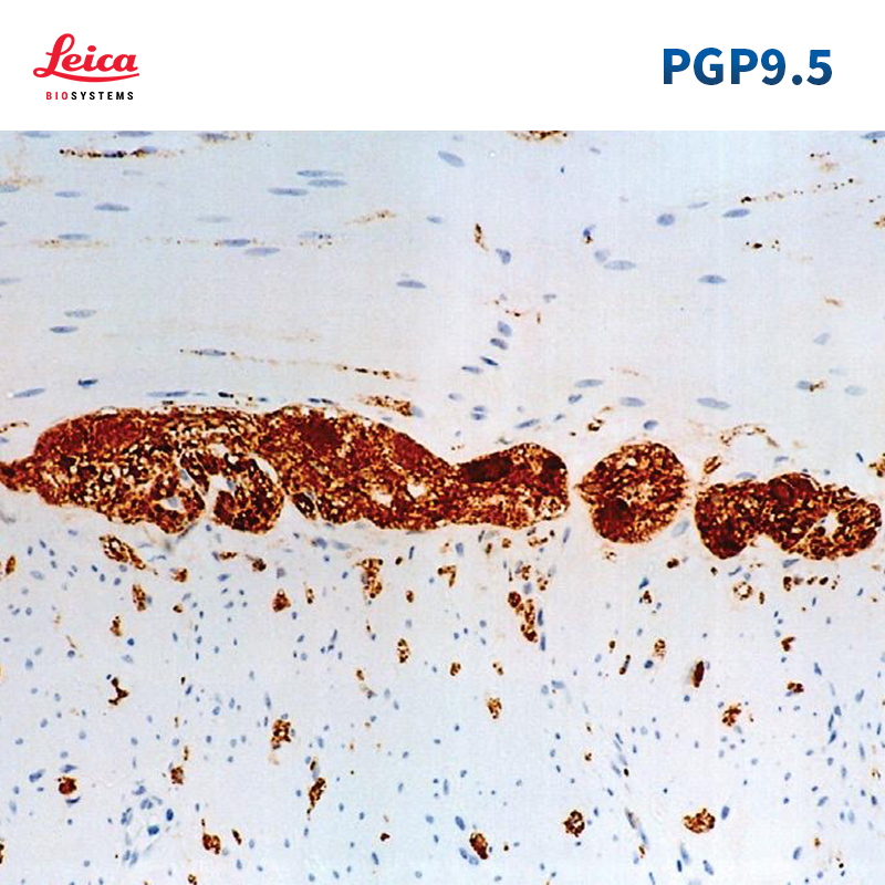 Protein Gene Product 9.5抗体试剂