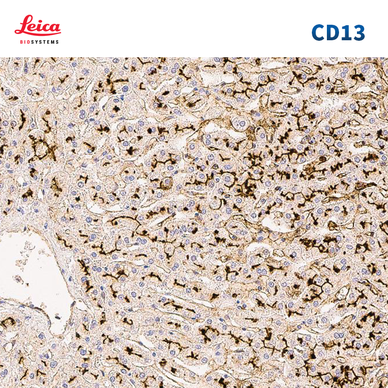 CD13抗体试剂