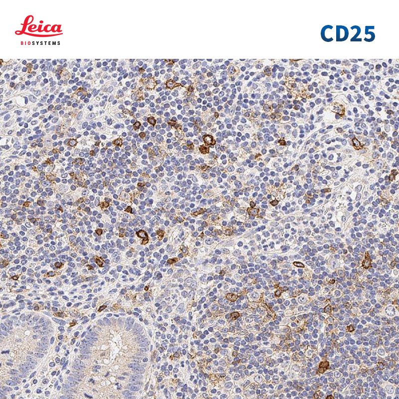CD25抗体试剂