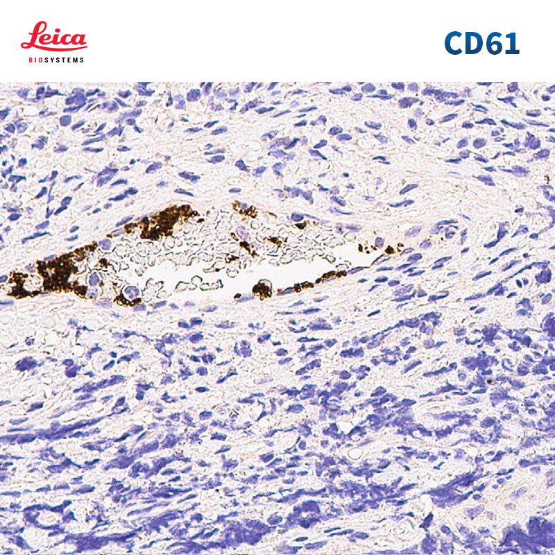 CD61抗体试剂