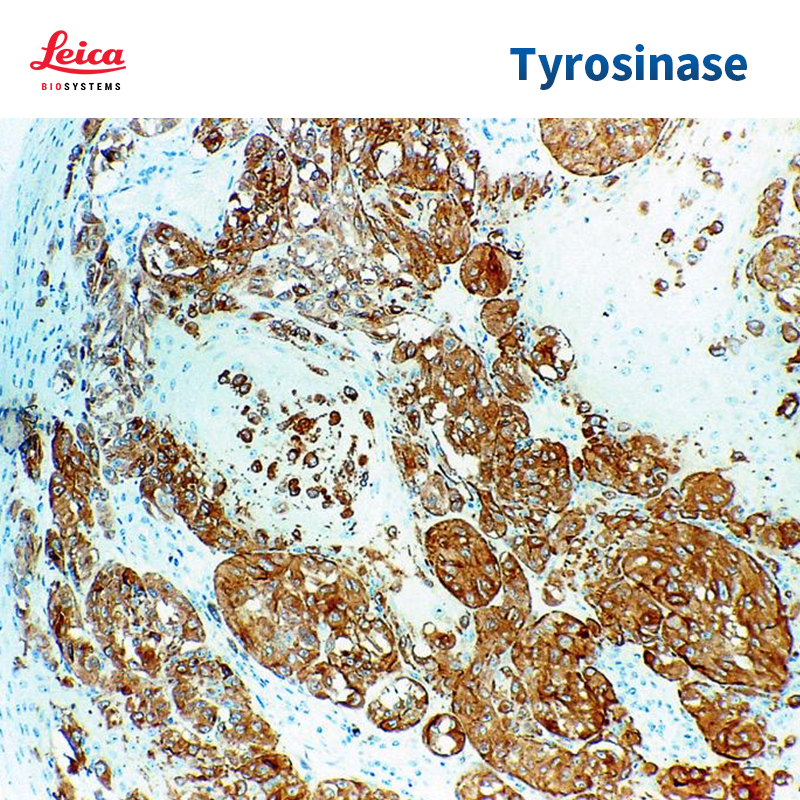 Tyrosinase抗体试剂