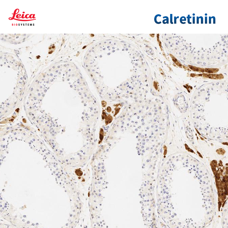 Calretinin抗体试剂