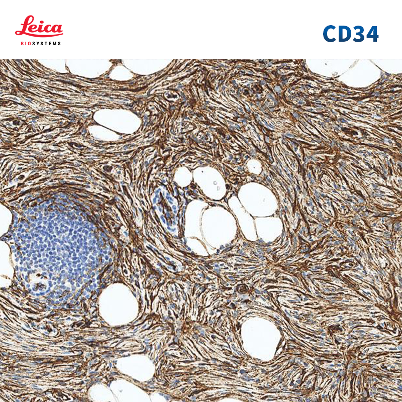 CD34（QBEnd/10）抗体试剂