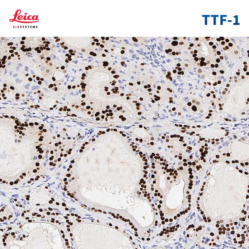 甲状腺转录因子-1（TTF-1）抗体试剂