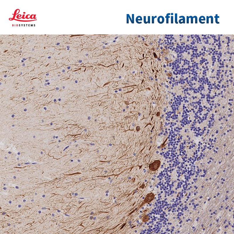 Neurofilament抗体试剂