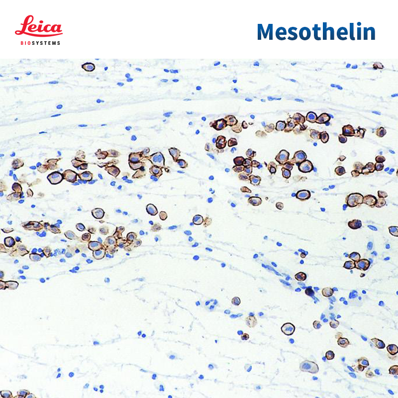 间皮素（Mesothelin）抗体试剂
