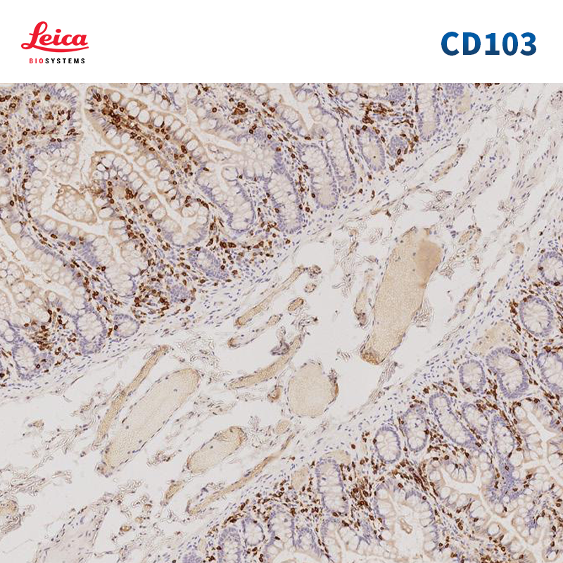 CD103抗体试剂
