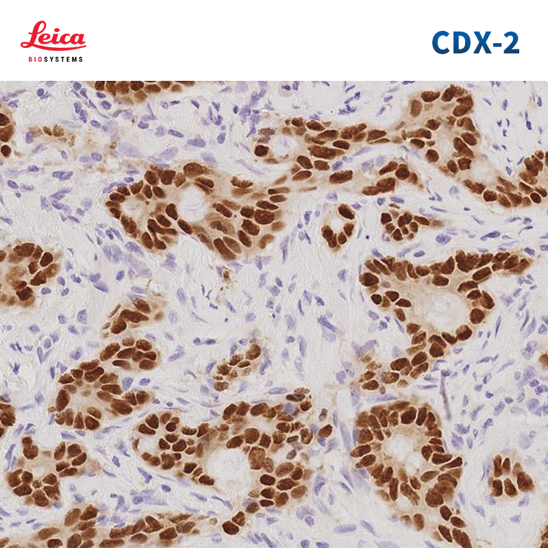 CDX-2抗体试剂