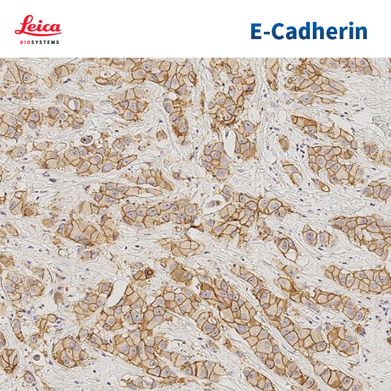 E-Cadherin抗体试剂
