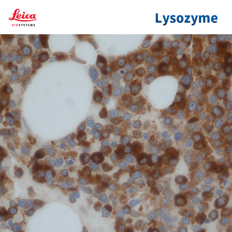 Lysozyme抗体试剂