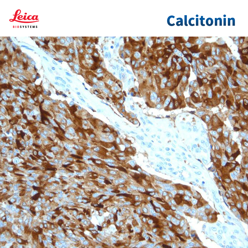 Calcitonin降钙素抗体试剂