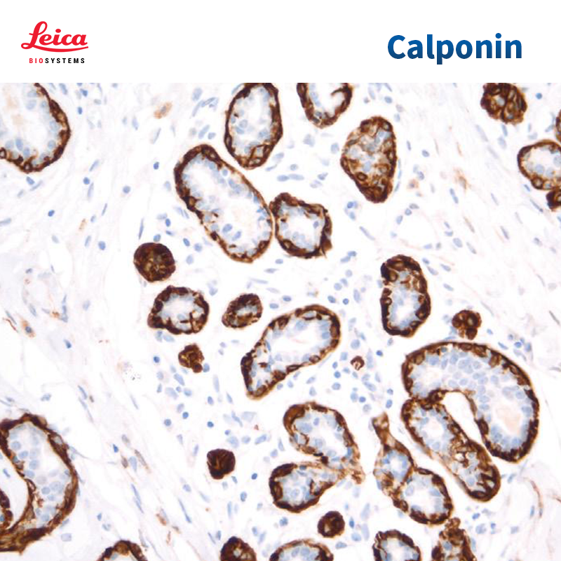 Calponin抗体试剂