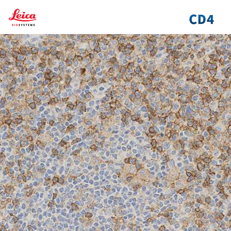 CD4抗体试剂