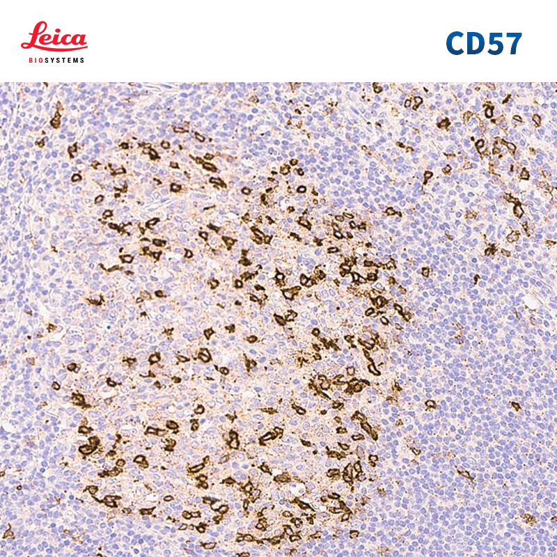 CD57抗体试剂