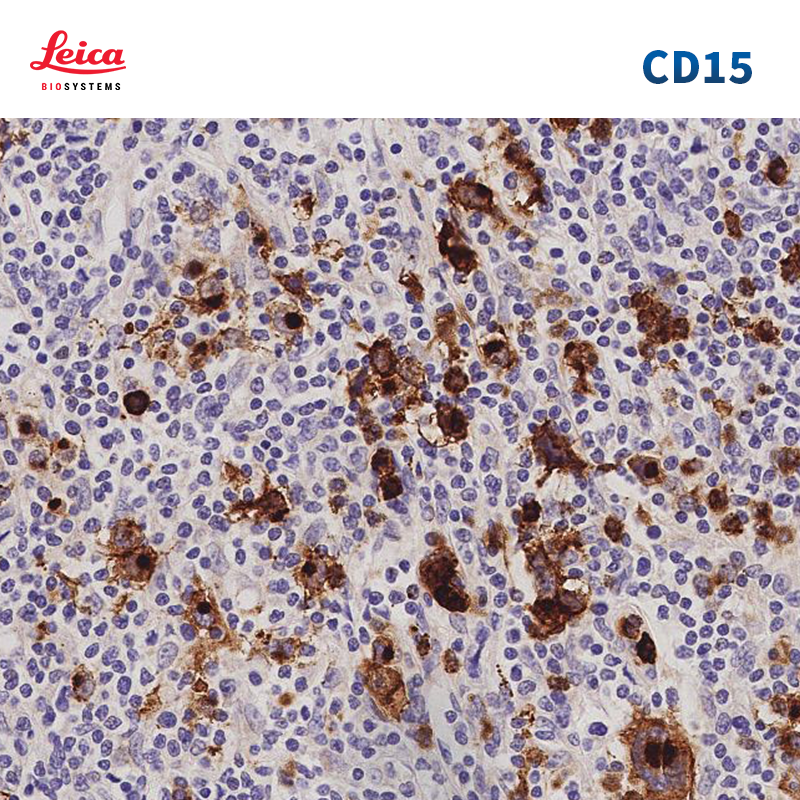 CD15抗体试剂