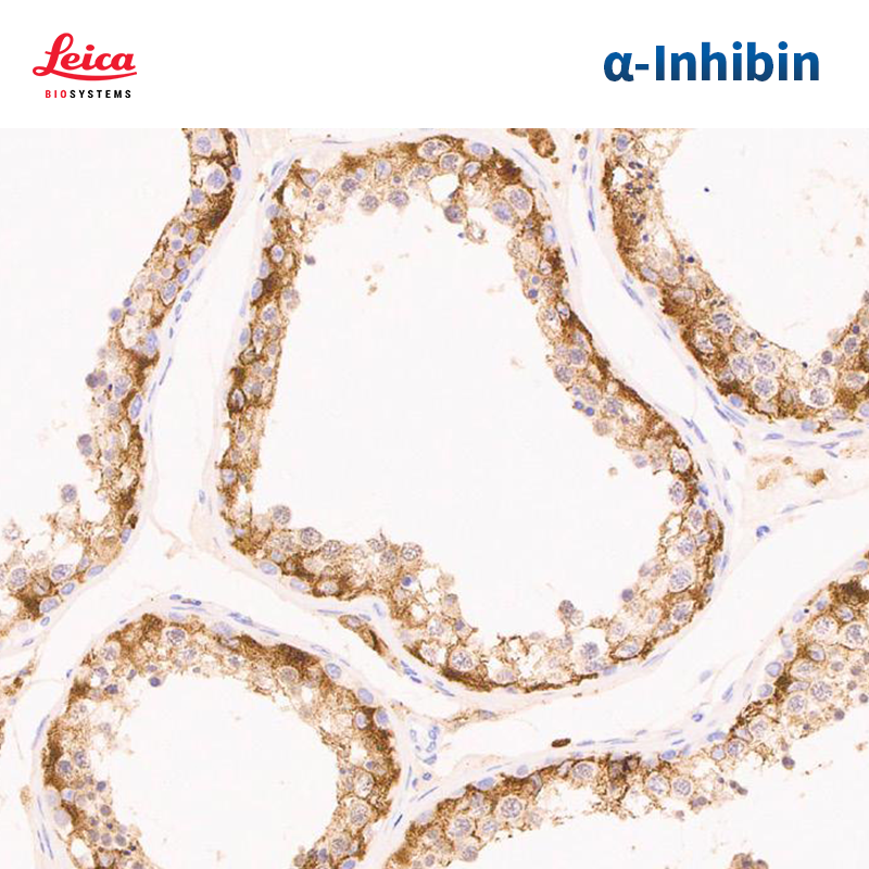 Inhibin, alpha抗体试剂