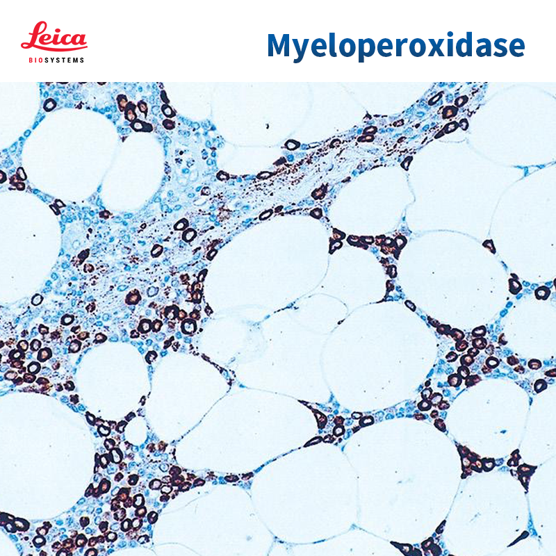 Myeloperoxidase抗体试剂