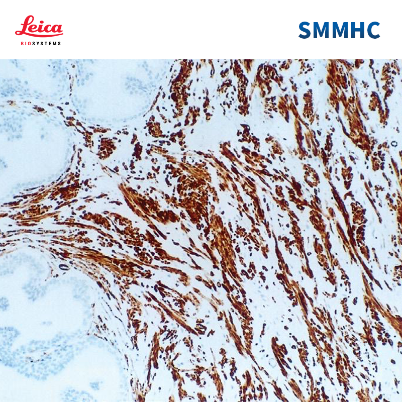 肌球蛋白重链（Myosin Heavy Chain）抗体试剂