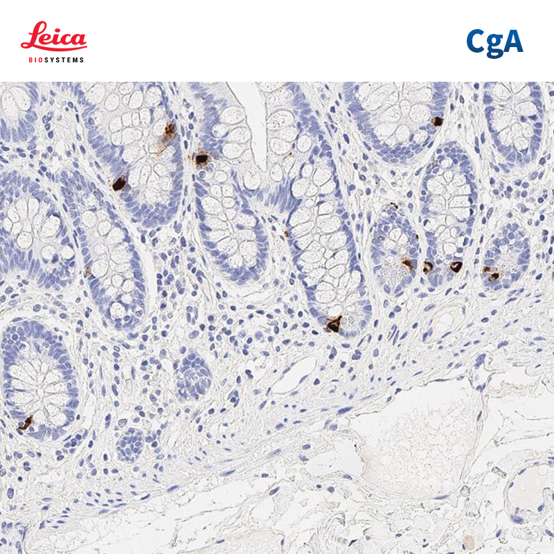 嗜铬粒蛋白A（Chromogranin A）抗体试剂