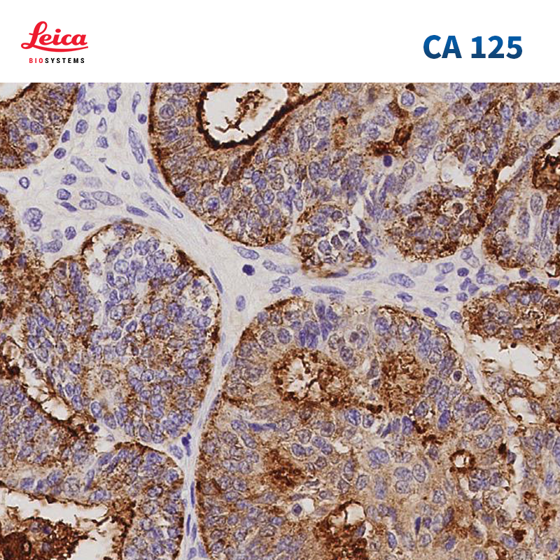CA 125抗体试剂