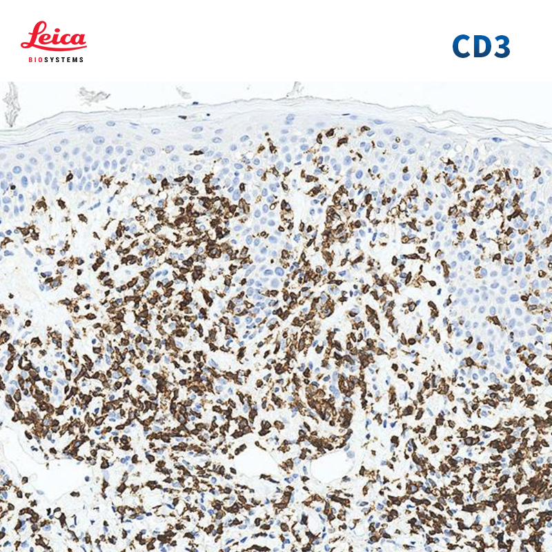 CD3（LN10）抗体试剂