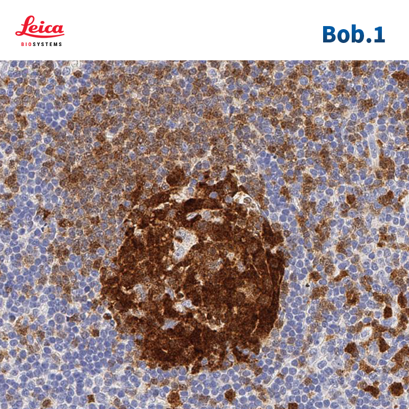 B淋巴细胞特异性激活OCT结合蛋白1（Bob.1）抗体试剂