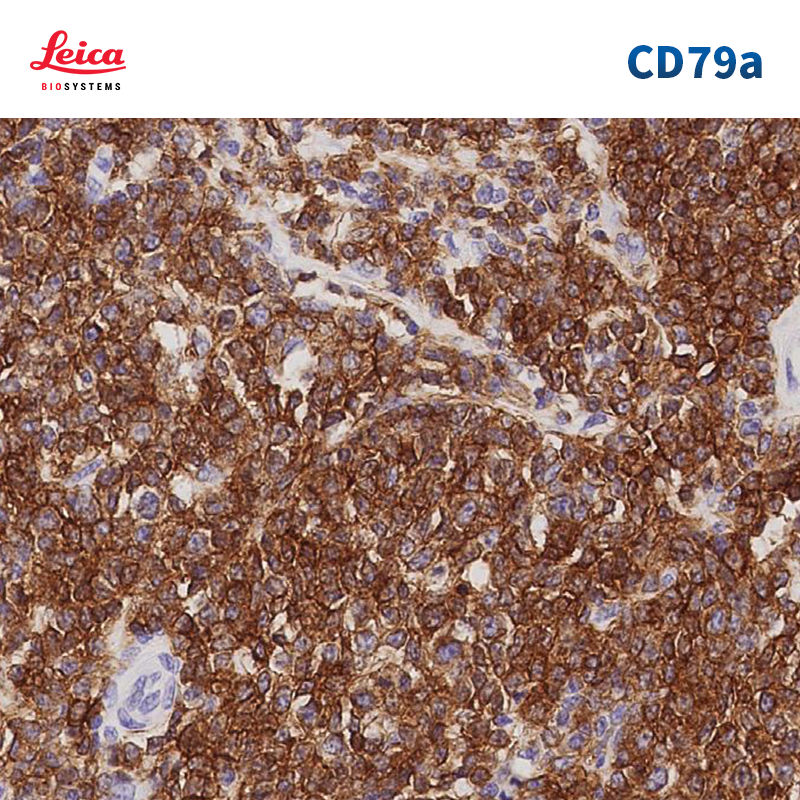 CD79a抗体试剂