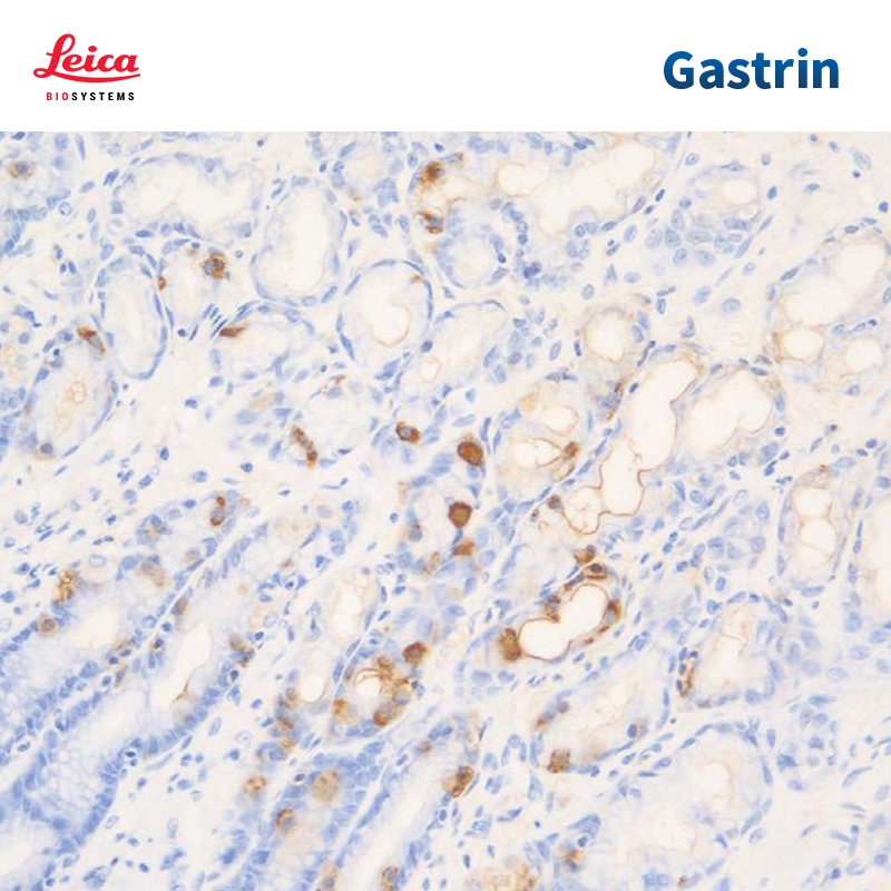 Gastrin抗体试剂